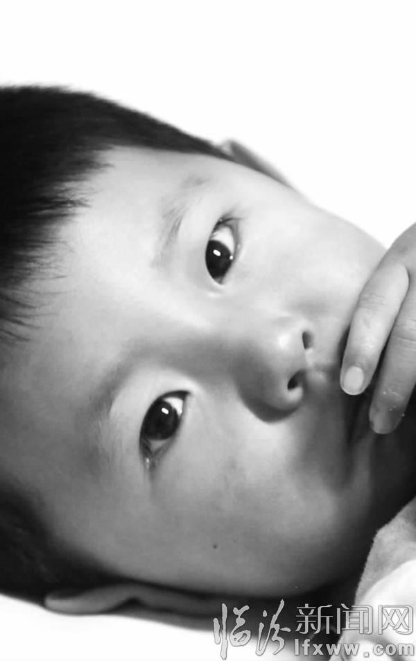 临汾《微友汇聚爱心 救助烧伤女童》后续