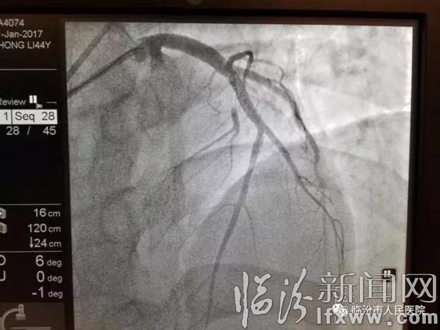 临汾市人民医院急救绿色体系建立成效显著